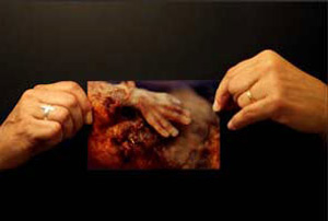 New York Times image of an aborted baby hand.